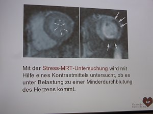 Herzsportgruppe blickt auf ein erfolgreiches Jahr zur&uuml;ck