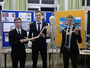 Ergebnisse der Kolloquien vorgestellt:  "Armprothesen - Otto Bock"