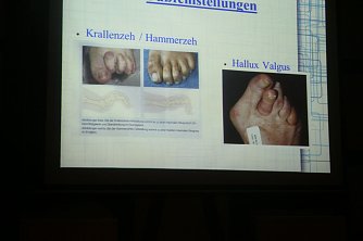 F&uuml;r die Schockmomente des Abends sorgte der Vortrag der Podologin Petra  B&ouml;senberg (Foto: Angelo Glashagel)