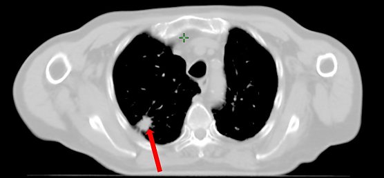 Vor der Bestrahlung (Foto: SHK)