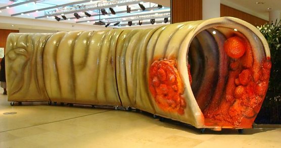 Ab durch den Dickdarm (Foto: Dr. Ibe)