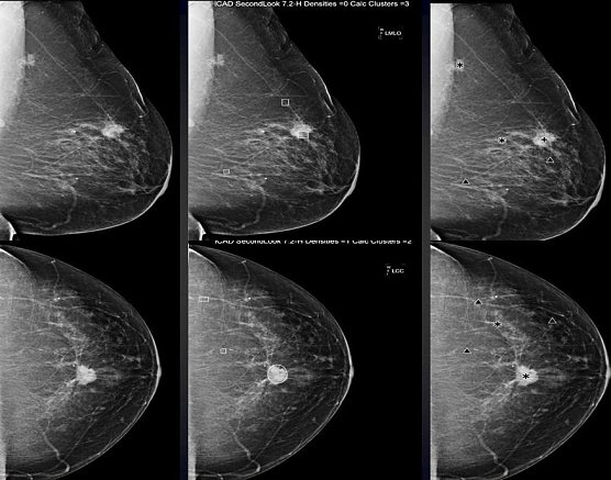 Darstellung (Foto: privat/SHK)