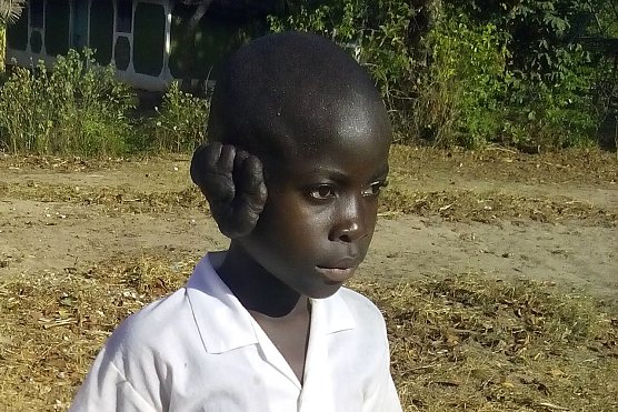 Neema kann geholfen werden (Foto: Ferdinand Chai)