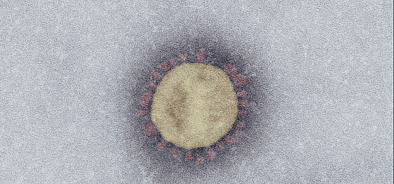 SARS-Coronavirus-2 (SARS-CoV-2, Isolat SARS-CoV-2/Italy-INMI1). Elektronenmikroskopie, Negativkontrastierung (PTA). Ma&szlig;stab: 100 nm  (Foto: Robert-Koch-Institut)