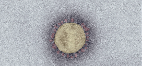SARS-Coronavirus-2 (SARS-CoV-2, Isolat SARS-CoV-2/Italy-INMI1). Elektronenmikroskopie, Negativkontrastierung (PTA). Ma&szlig;stab: 100 nm (Foto: Robert-Koch-Institut)
