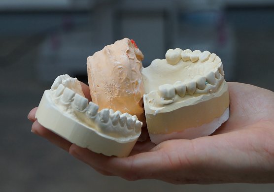 Eine Befragung soll kl&auml;ren wie Gipsabf&auml;lle aus Unternehmen, z.B. Formgipse aus der Dentalindustrie, zuk&uuml;nftig recycelt werden k&ouml;nnen (Foto: Katrin Schmidt)
