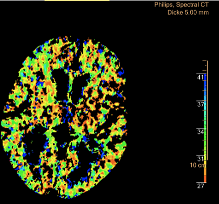 Die Bildgebungsm&ouml;glichkeiten der neuen Technik er&ouml;ffnen den &Auml;rzten "neue Dimensionen" der Diagnose (Foto: S&uuml;dharz-Klinikum)