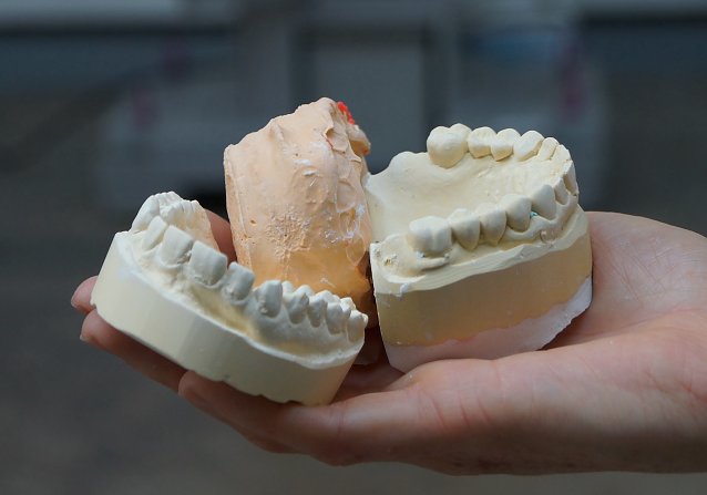Bild: Eine Befragung soll kl&auml;ren wie Gipsabf&auml;lle aus Unternehmen, z.B. Formgipse aus der Dentalindustrie, zuk&uuml;nftig recycelt werden k&ouml;nnen