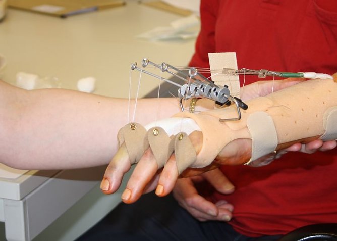 Nach der OP (Foto: Klinik Bleicherode) Nach der OP (Foto: Klinik Bleicherode)