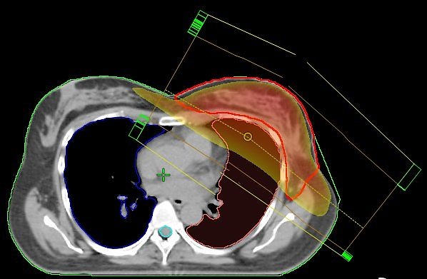 Stehfeldtechnik (Foto: S&uuml;dharz Klinikum)