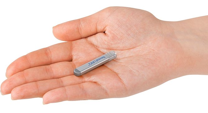 Das kleinste EKG der Welt (Foto: S&uuml;dharz Klinikum)