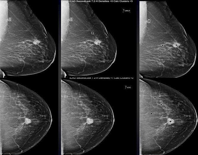 Darstellung (Foto: privat/SHK) Darstellung (Foto: privat/SHK)