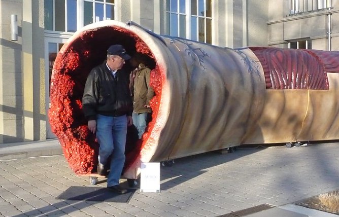 Informationen zu Darmkrebs (Foto: nnz) Informationen zu Darmkrebs (Foto: nnz)