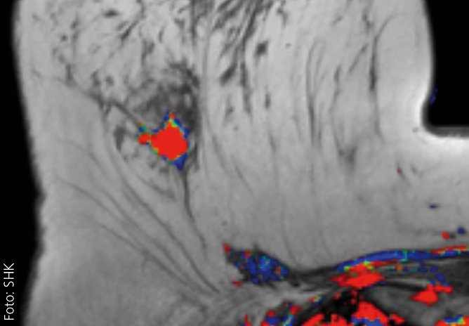 Bildgebung bei Mammokarzinomen (Foto: SHK)