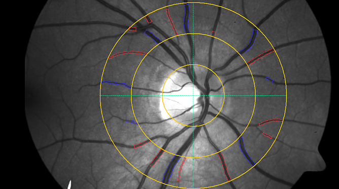Weiterbildung im SBZ Vor Genr&ouml;te (Foto: Landratsamt Nordhausen)