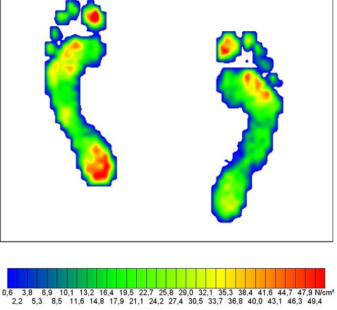 Gemessen (Foto: HdG)