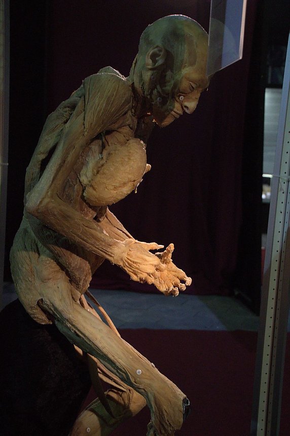 Echte K&ouml;rper zum Bestaunen