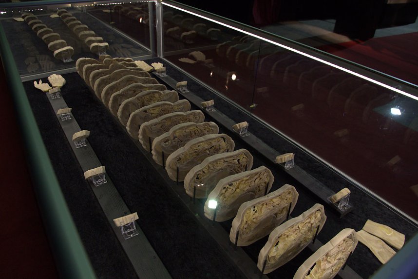 Echte K&ouml;rper zum Bestaunen