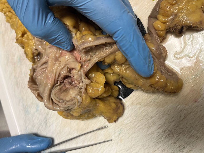 Praixs Besuch in der Pathologie des S&uuml;dharz Klinikums